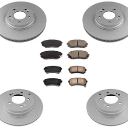 Brake Rotors and Brake Pads 16-19 Hyundai Sonata GL 2.4L w/ Manual Parking Brake