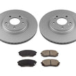 Front Rotors and Brake Pads 16-19 Hyundai Sonata GL 2.4L w/ Manual Parking Brake